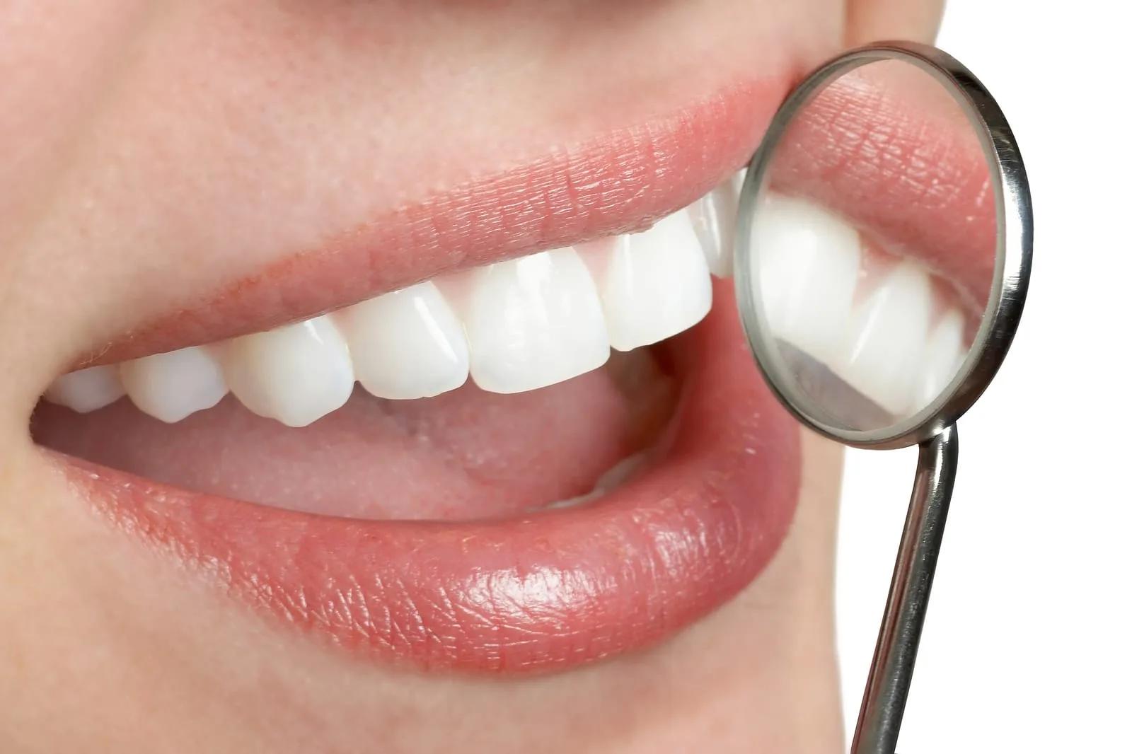 Brighten Your Smile with Teeth Whitening in Nottingham
