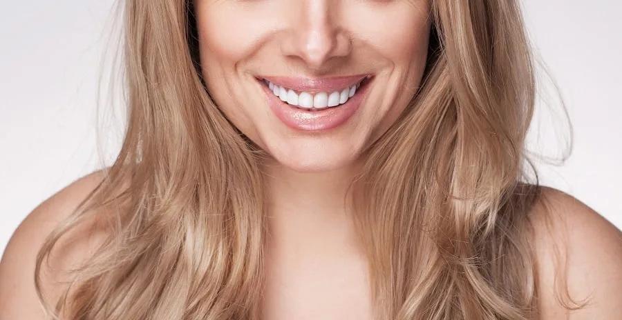 Should I get veneers?