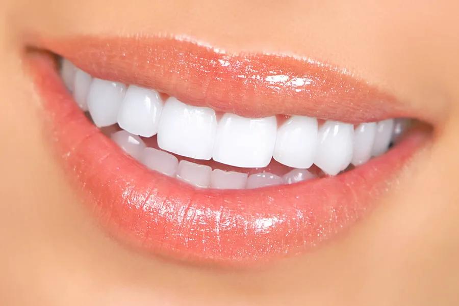 Whiten with care!
