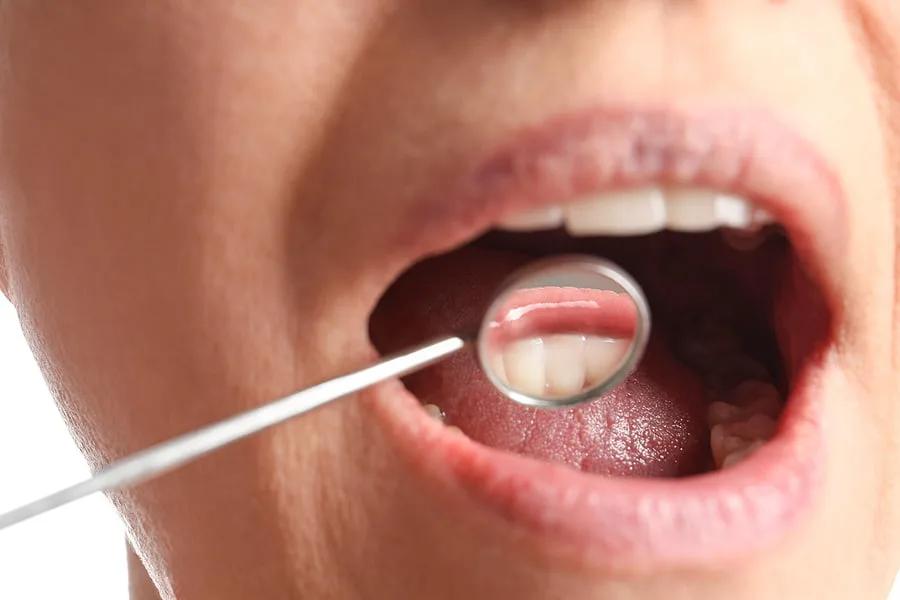 Why You Can’t Afford To Skip Dental Check-ups