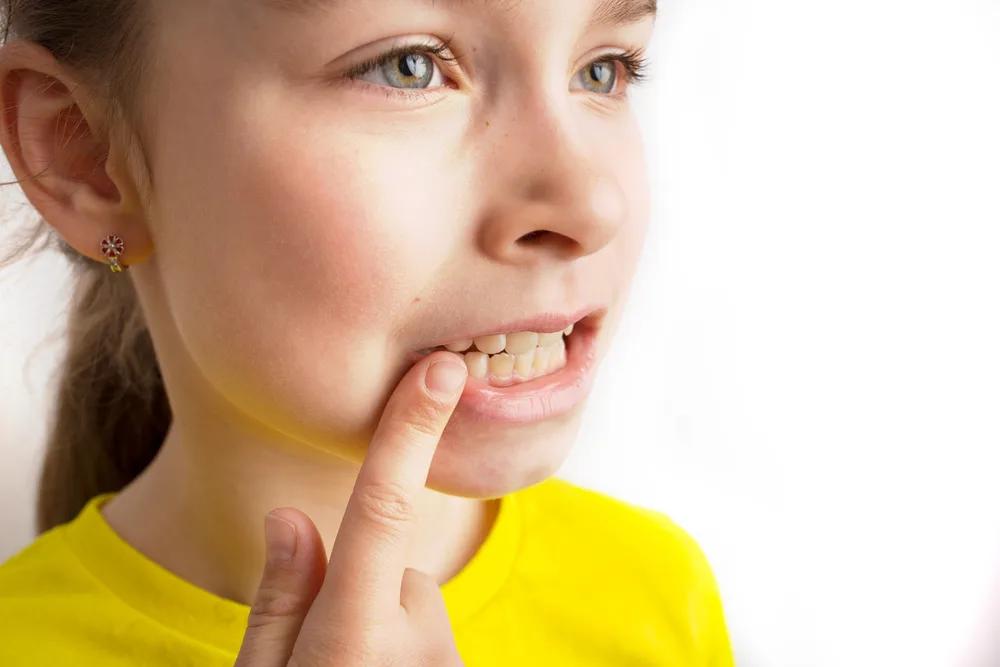 The Hidden Cost of Delayed Orthodontic Treatment: What Nottingham Parents Need to Know