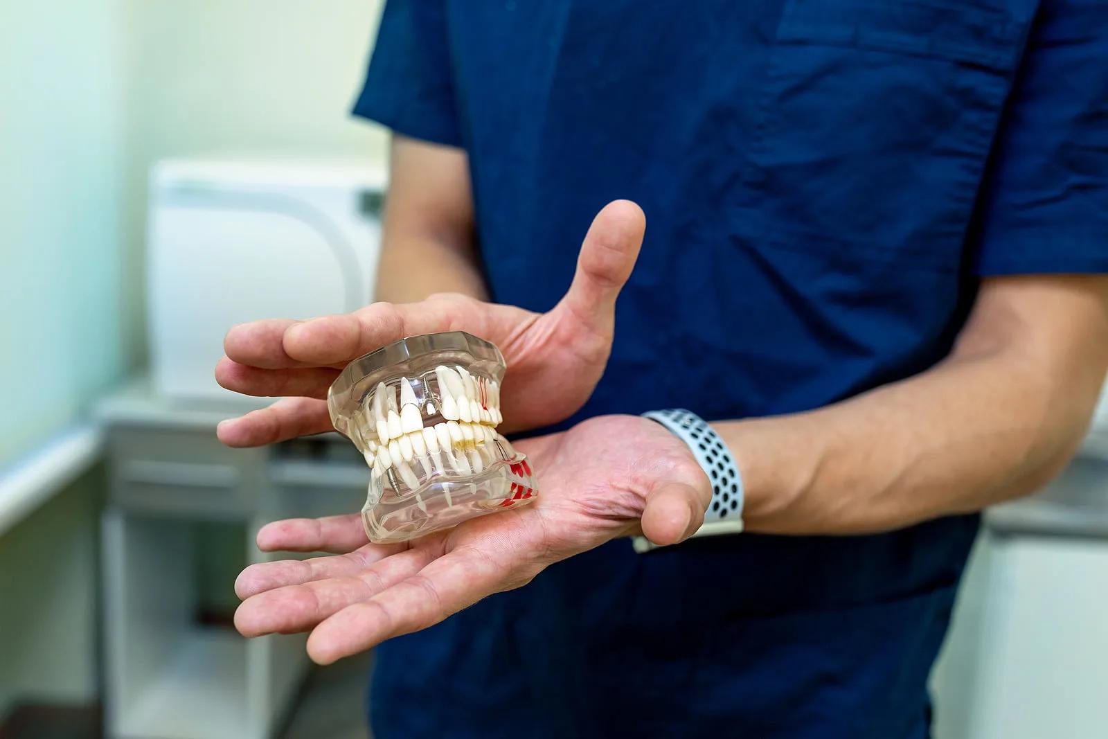 Why You Should Prioritise Your Oral Health With Dental Implants